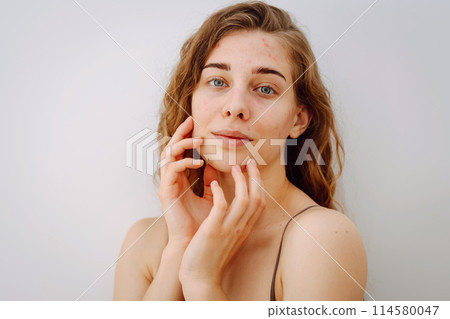Close-up portrait of a beautiful woman without makeup with imperfect skin. Acne skin. Natural beauty Close-up portrait of a beautiful woman without makeup with imperfect skin. Acne skin. Natural beauty 114580047
