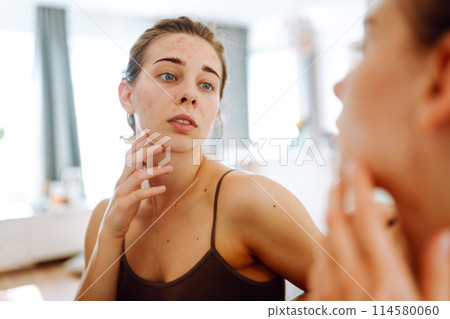 Portrait of a young woman touching pimple on her face while looking in mirror. Facial skin problems. 114580060