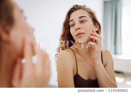 Portrait of a young woman touching pimple on her face while looking in mirror. Facial skin problems. 114580062