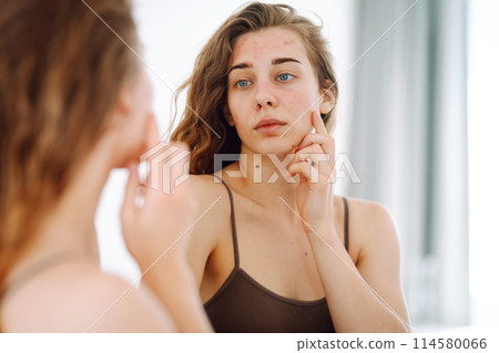 Portrait of a young woman touching pimple on her face while looking in mirror. Facial skin problems. Portrait of a young woman touching pimple on her face while looking in mirror. Facial skin problems. 114580066