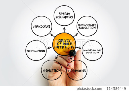 Causes of male infertility mind map text concept for presentations and reports 114584449