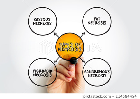 Types of Necrosis (death of body tissue) mind map text concept for presentations and reports 114584454