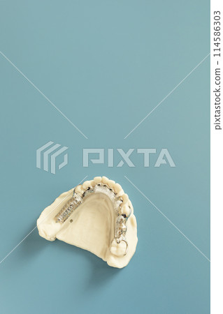 Mockup Metal Frame Lower Partial Denture, Plate On Die Stone, Plaster Cast Mold Of Lower Jaws, Cobalt Chrome Dental Plate, Mockup 3D Printed Bridge On Blue Background. Copy Space. Vertical Flatly Mockup Metal Frame Lower Partial Denture, Plate On Die Stone, Plaster Cast Mold Of Lower Jaws, Cobalt Chrome Dental Plate, Mockup 3D Printed Bridge On Blue Background. Copy Space. Vertical Flatly 114586303
