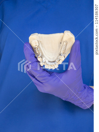 Dentist Holding Metal Frame Lower Partial Denture with Die Stone, Plaster Cast Molds Of Lower Jaws, Cobalt Chrome Dental Plate, 3D Printed Bridge. Vertical Plane Dentist Holding Metal Frame Lower Partial Denture with Die Stone, Plaster Cast Molds Of Lower Jaws, Cobalt Chrome Dental Plate, 3D Printed Bridge. Vertical Plane 114586307