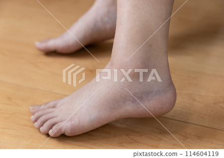 sprained ankle sprained ankle 114604119
