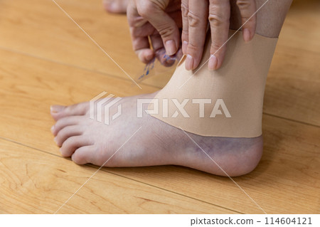 A woman applying a compress to her sprained ankle A woman applying a compress to her sprained ankle 114604121