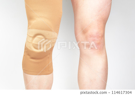 bandage for fixing the injured knee of the human leg on a white background.  114617304