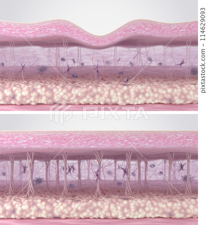 Fibroblast activation and collagen fibers regeneration in the skin extracellular matrix. Cross-section of skin tissues before and after anti-aging wrinkle reduction treatment. 3d illustration 114629093