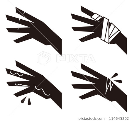 Monochrome icon illustration set of chapped, bleeding, bandaged hands, etc. 114645202