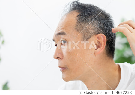 Middle-aged men, hair care, hairline Middle-aged men, hair care, hairline 114657238