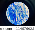 AFB 3+ sample collect sputum. 114676028