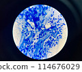 AFB 3+ sample collect sputum. 114676029