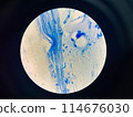 AFB 3+ sample collect sputum. 114676030