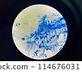 AFB 3+ sample collect sputum. 114676031