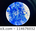 AFB 3+ sample collect sputum. 114676032