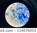 AFB 3+ sample collect sputum. 114676033
