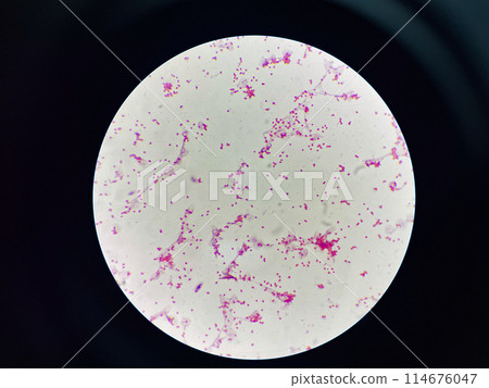 Bacteria cell gram neagtive bacilli. 114676047