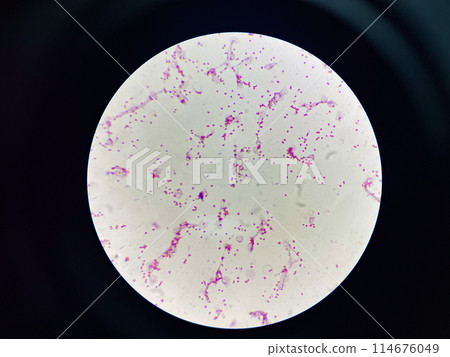Bacteria cell gram neagtive bacilli. Bacteria cell gram neagtive bacilli. 114676049