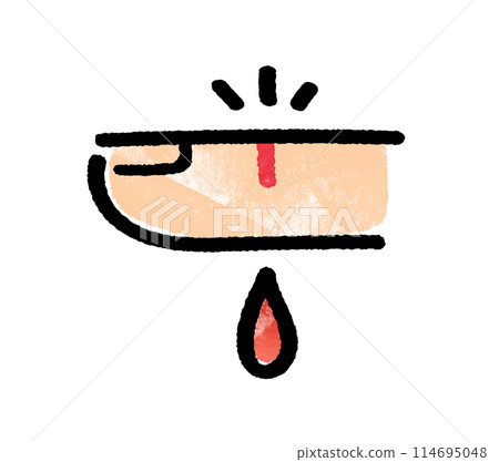 Finger injury 114695048