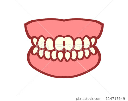 Cosmetic dentistry, white teeth dentures illustration material 114717649