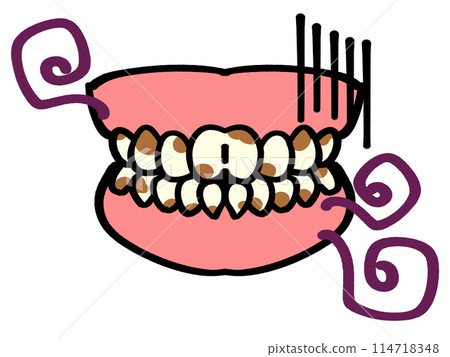 Cosmetic dentistry, dirty teeth dentures illustration material 114718348