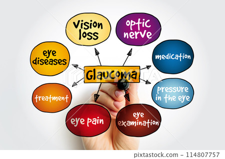 Glaucoma is a group of eye diseases that result in damage to the optic nerve (or retina) and cause vision loss, mind map medical concept background 114807757