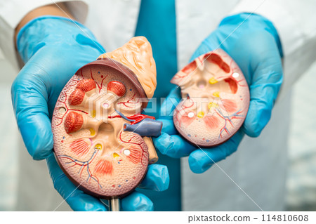 Kidney disease, Chronic kidney disease ckd, Doctor with human model to study and treat in hospital. 114810608