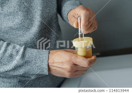 a man is filling a tube with a urine sample a man is filling a tube with a urine sample 114813944
