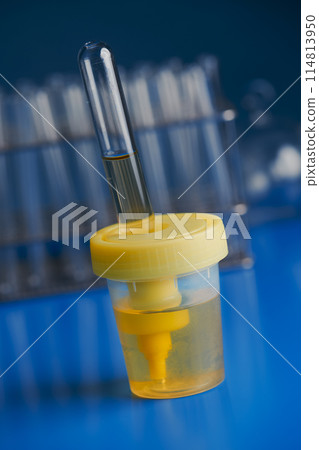 a sample of urine in the laboratory 114813950