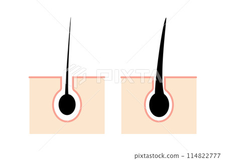 頭髮健康狀況比較圖 114822777