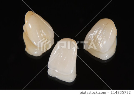 Get your teeth fixed with beautiful ceramic at the dentist Get your teeth fixed with beautiful ceramic at the dentist 114835752