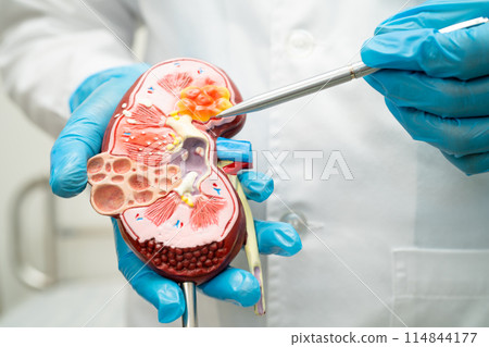 Kidney disease, Chronic kidney disease ckd, Doctor with human model to study and treat in hospital. Kidney disease, Chronic kidney disease ckd, Doctor with human model to study and treat in hospital. 114844177