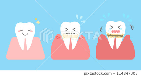 牙周病的進展 牙齒的簡單圖示 114847305