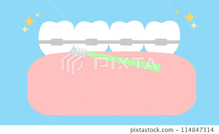 Oral and dental care illustrations: Orthodontics 114847314