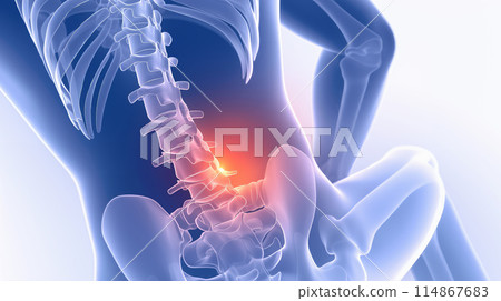 "Visual representation of lower back pain: A tangible image of pain and discomfort in the lumbar region." <AI-generated material> 114867683