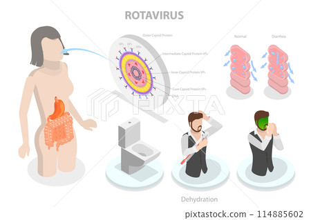 3D Isometric Flat Conceptual Illustration of Rotavirus Infection, Diarrhea, Vomiting and Dehydration 3D Isometric Flat Conceptual Illustration of Rotavirus Infection, Diarrhea, Vomiting and Dehydration 114885602