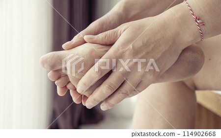 dirty and neglected feet 114902668