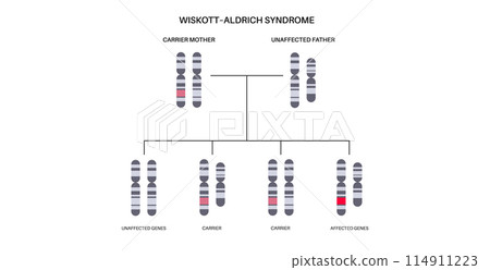 Wiskott Aldrich syndrome Wiskott Aldrich syndrome 114911223