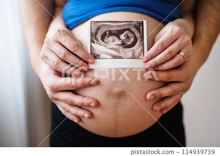 Pregnant woman and her partner, touching her naked belly. Holding ultrasound scan picture. 114939739