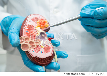 Kidney disease, Chronic kidney disease ckd, Doctor with human model to study and treat in hospital. 114945458