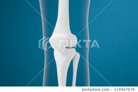 Leg bones and knees, 3d rendering. Leg bones and knees, 3d rendering. 114947676