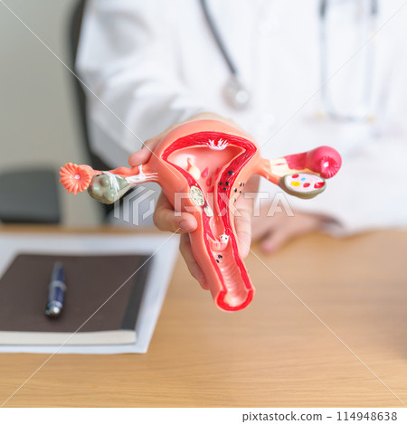 Doctor with Uterus and Ovaries anatomy model. Ovarian and Cervical cancer, Cervix disorder, Endometriosis, Hysterectomy, Uterine fibroids, Reproductive system, Pregnancy and health concept 114948638