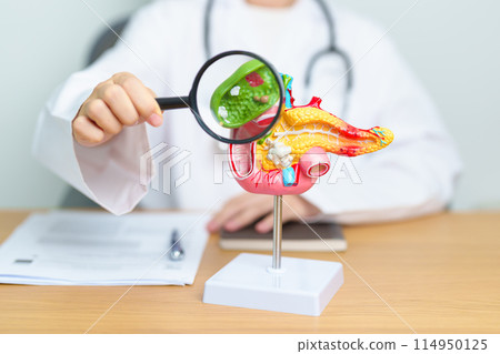 Doctor with human Pancreatitis anatomy model with Pancreas, Gallbladder, Bile Duct, Duodenum, Small intestine and magnifying glass. Pancreatic cancer, acute pancreatitis and Digestive system 114950125
