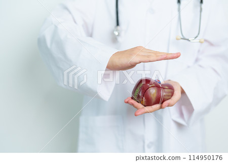 Doctor with human Liver anatomy model. Liver cancer and Tumor, Jaundice, Viral Hepatitis A, B, C, D, E, Cirrhosis, Failure, Enlarged, Hepatic Encephalopathy, Ascites Fluid in Belly and health concept Doctor with human Liver anatomy model. Liver cancer and Tumor, Jaundice, Viral Hepatitis A, B, C, D, E, Cirrhosis, Failure, Enlarged, Hepatic Encephalopathy, Ascites Fluid in Belly and health concept 114950176