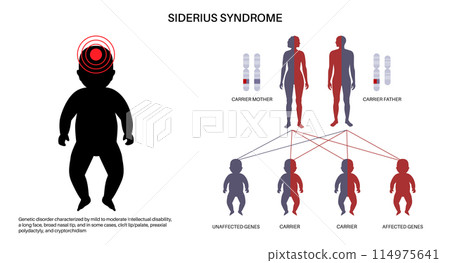 Siderius syndrome scheme 114975641
