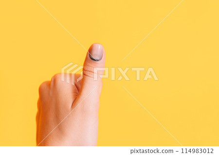 Hematoma under the nail with manicure on the thumb against a yellow background Hematoma under the nail with manicure on the thumb against a yellow background 114983012