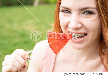 Beautiful young woman with braces on her teeth eats a watermelon-shaped lollipop outdoors. Beautiful young woman with braces on her teeth eats a watermelon-shaped lollipop outdoors. 114994925