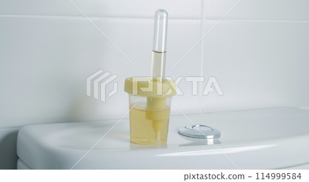 urine sample in a sterile container, banner format 114999584