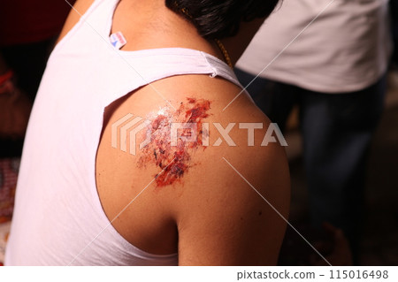Male hand with Blood 115016498