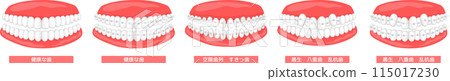 Clear brackets orthodontic set Clear brackets orthodontic set 115017230